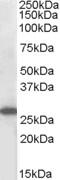 Suppressor Of Cytokine Signaling 3 antibody, 46-409, ProSci, Western Blot image 