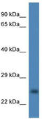 Copper Chaperone For Superoxide Dismutase antibody, TA343094, Origene, Western Blot image 