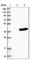 Proenkephalin-A antibody, HPA013138, Atlas Antibodies, Western Blot image 