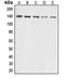 Collagen Type III Alpha 1 Chain antibody, orb213759, Biorbyt, Western Blot image 