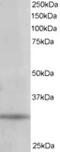 Phosphatidylinositol Transfer Protein Alpha antibody, MBS420567, MyBioSource, Western Blot image 