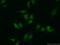 Transitional endoplasmic reticulum ATPase antibody, 10736-1-AP, Proteintech Group, Immunofluorescence image 