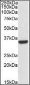 Calponin 2 antibody, orb95347, Biorbyt, Western Blot image 