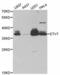 Transcription factor ETV7 antibody, abx004777, Abbexa, Western Blot image 