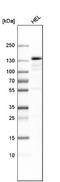 Pre-MRNA Processing Factor 4B antibody, NBP1-82999, Novus Biologicals, Western Blot image 
