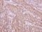 X-Linked Inhibitor Of Apoptosis antibody, PA5-29644, Invitrogen Antibodies, Immunohistochemistry paraffin image 