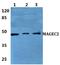 Melanoma-associated antigen C2 antibody, A05335-1, Boster Biological Technology, Western Blot image 