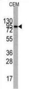 Phosphoinositide-3-Kinase Regulatory Subunit 1 antibody, abx033824, Abbexa, Immunohistochemistry frozen image 