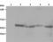 LYN Proto-Oncogene, Src Family Tyrosine Kinase antibody, LS-C46037, Lifespan Biosciences, Western Blot image 