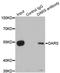 Aspartyl-TRNA Synthetase antibody, LS-C334805, Lifespan Biosciences, Immunoprecipitation image 