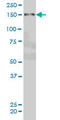 Zinc Finger MYND-Type Containing 8 antibody, LS-C134050, Lifespan Biosciences, Western Blot image 
