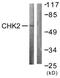 Checkpoint Kinase 2 antibody, LS-C117804, Lifespan Biosciences, Western Blot image 