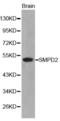 Sphingomyelin Phosphodiesterase 2 antibody, abx001080, Abbexa, Western Blot image 