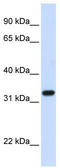 Tubulin Folding Cofactor B antibody, TA340004, Origene, Western Blot image 