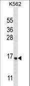 StAR Related Lipid Transfer Domain Containing 5 antibody, LS-C161546, Lifespan Biosciences, Western Blot image 