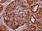 Leucine Rich Pentatricopeptide Repeat Containing antibody, CSB-PA013105LA01HU, Cusabio, Immunohistochemistry paraffin image 