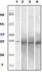 RAB25, Member RAS Oncogene Family antibody, MA5-15267, Invitrogen Antibodies, Western Blot image 