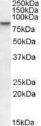 SET Domain Bifurcated Histone Lysine Methyltransferase 2 antibody, PA1-31091, Invitrogen Antibodies, Western Blot image 