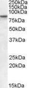 SET Domain Bifurcated Histone Lysine Methyltransferase 2 antibody, PA1-31091, Invitrogen Antibodies, Western Blot image 