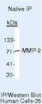 Matrix Metallopeptidase 2 antibody, MA5-14186, Invitrogen Antibodies, Immunoprecipitation image 