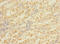 Mitogen-Activated Protein Kinase Kinase Kinase 7 antibody, A62934-100, Epigentek, Immunohistochemistry paraffin image 