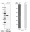 Keratin-17 antibody, NBP2-38536, Novus Biologicals, Western Blot image 