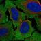 Frizzled Class Receptor 4 antibody, NBP2-57807, Novus Biologicals, Immunofluorescence image 