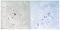 Insulin Like Growth Factor 1 Receptor antibody, PA5-37604, Invitrogen Antibodies, Immunohistochemistry paraffin image 