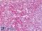 Platelet Derived Growth Factor Receptor Alpha antibody, LS-B9120, Lifespan Biosciences, Immunohistochemistry paraffin image 