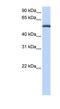 Lactamase Beta antibody, NBP1-54686, Novus Biologicals, Western Blot image 