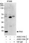 Peptidylprolyl Cis/Trans Isomerase, NIMA-Interacting 1 antibody, A302-315A, Bethyl Labs, Immunoprecipitation image 