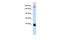 Ligand Dependent Nuclear Receptor Corepressor antibody, GTX45300, GeneTex, Western Blot image 