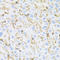 Insulin Receptor antibody, LS-C330901, Lifespan Biosciences, Immunohistochemistry paraffin image 