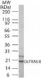 TNF Receptor Superfamily Member 10c antibody, NB100-56445, Novus Biologicals, Western Blot image 