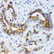 Matrix Metallopeptidase 7 antibody, LS-C331076, Lifespan Biosciences, Immunohistochemistry paraffin image 