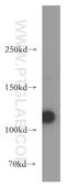 Polycystin 2, Transient Receptor Potential Cation Channel antibody, 19126-1-AP, Proteintech Group, Western Blot image 