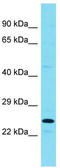 Regulation Of Nuclear Pre-MRNA Domain Containing 1B antibody, TA344727, Origene, Western Blot image 
