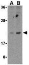 BCL2 Like 14 antibody, GTX31280, GeneTex, Western Blot image 
