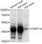Creatine Kinase, Mitochondrial 1B antibody, A16590, Boster Biological Technology, Western Blot image 