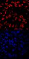 Eomesodermin antibody, MAB6166, R&D Systems, Immunocytochemistry image 