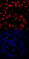 Eomesodermin antibody, MAB6166, R&D Systems, Immunocytochemistry image 