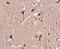 Zinc Finger Protein 667 antibody, NBP1-77357, Novus Biologicals, Immunohistochemistry paraffin image 