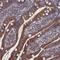 Spermatogenesis Associated 13 antibody, HPA040185, Atlas Antibodies, Immunohistochemistry frozen image 
