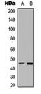 Beta-1,4-Galactosyltransferase 6 antibody, LS-C354288, Lifespan Biosciences, Western Blot image 