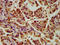 SLC2A4 Regulator antibody, LS-C672274, Lifespan Biosciences, Immunohistochemistry paraffin image 