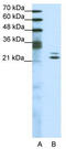 BUD31 Homolog antibody, TA343433, Origene, Western Blot image 