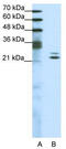 Protein BUD31 homolog antibody, TA343433, Origene, Western Blot image 