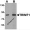 Tripartite Motif Containing 71 antibody, 5881, ProSci, Western Blot image 