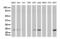 O-6-Methylguanine-DNA Methyltransferase antibody, LS-C796818, Lifespan Biosciences, Western Blot image 