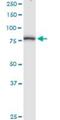 Methylmalonyl-CoA Mutase antibody, H00004594-D01P, Novus Biologicals, Western Blot image 